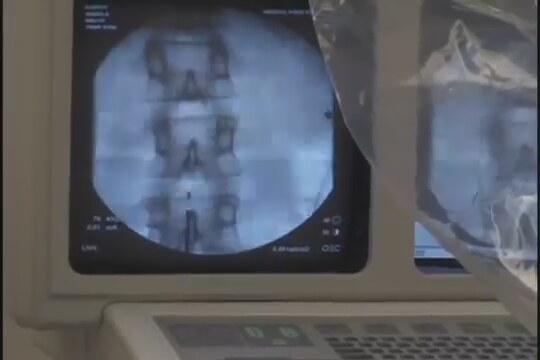 Orgasm Inc. Fragman